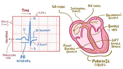 ecg nsr means|ECG normal sinus rhythm: Video, Anatomy & Definition .